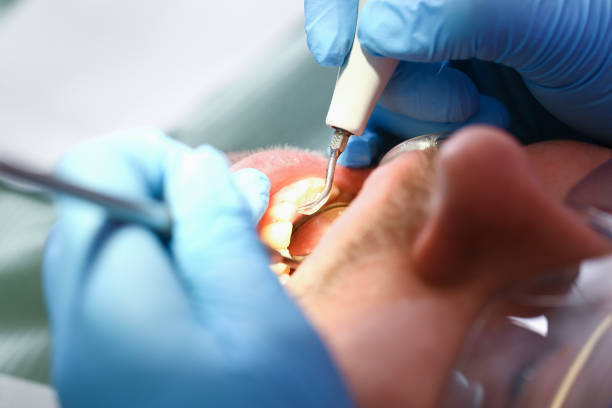 Best After-Hours Emergency Dentist in Norway, MI